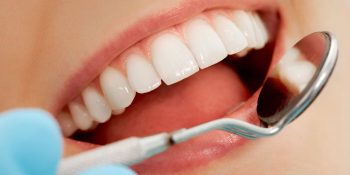 vancouver prosthodontist